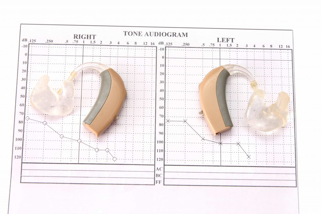 Hearing Test